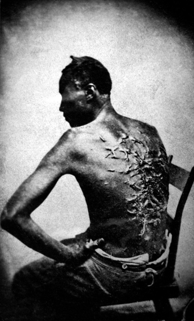Scars of Peter, 1863. A Whipped Mississippi Slave, Photo Taken April 2, 1863, Baton Rouge, Louisiana. National Archives and Records Administration